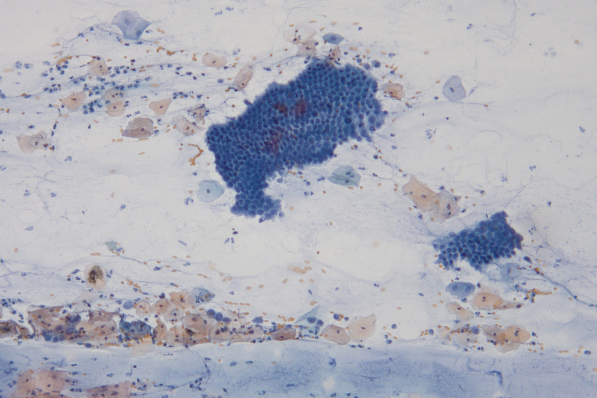 Komórki kanału szyjki macicy, układ plastra miodu